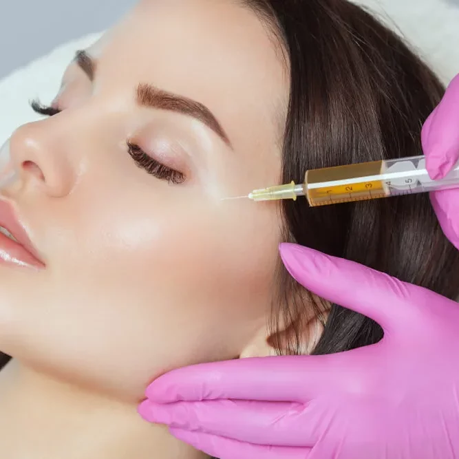 Platelet Rich Plasma PRP treatment at Alicia Beauty